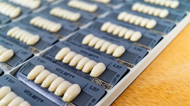 Dientes VITA MFT expuestos en bandejas